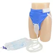Urine Collection System - 1