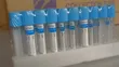 EDTA Collection Tubes (100 pcs) - 1