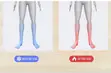 Wireless Remote Control Pulse Heating Foot Massager - 1