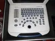 New Ultrasound Machine with Two Probes - 3