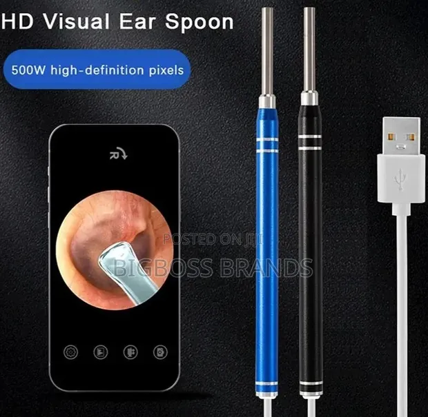 HD Video Otoscope - 1
