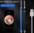 HD Video Otoscope - 1