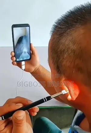 HD Video Otoscope