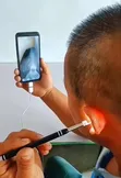 HD Video Otoscope - 2
