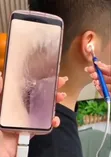 HD Video Otoscope - 3