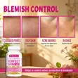 Acne Support Perfect Skin Dietary Supplement Capsules - 4