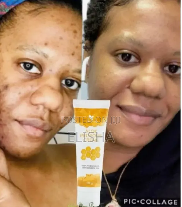 Aloe Propolis Creme by Forever Living - 1