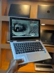 Dell Inspiron 11 3147 2-in-1 Laptop/Tablet - 2