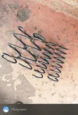 Subaru Outback Coil Springs (Used) - 2