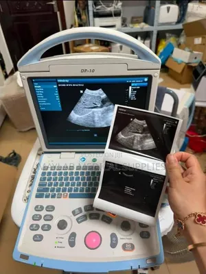 Mashine ya Mindray DP-10 Ultrasound - Mfumo wa Dijitali unaobebeka