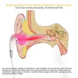 Tiba ya Laser kwa Tinnitus - 4