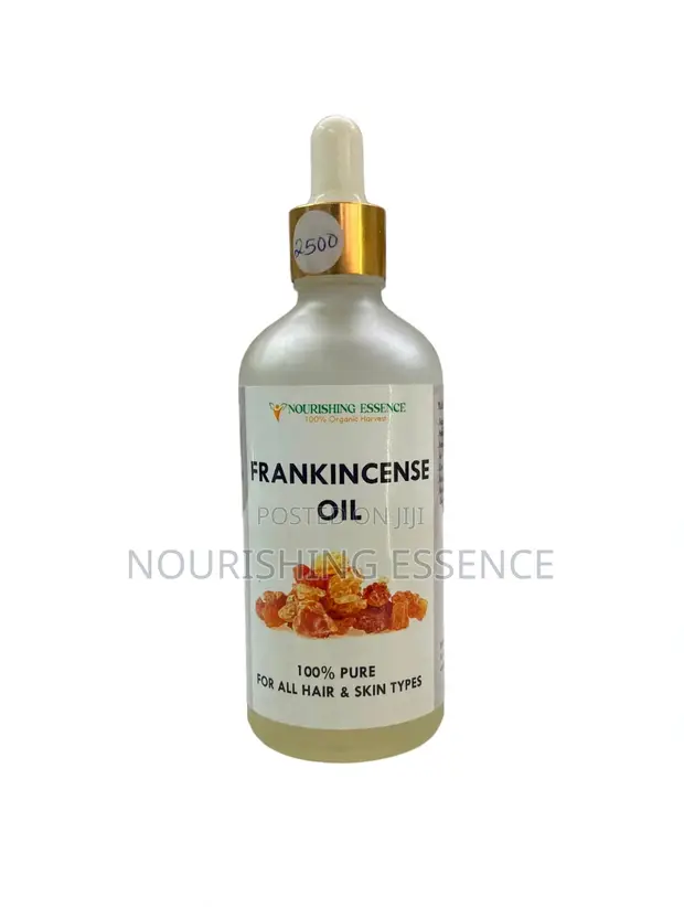 Frankincense Oil for Hair & Skin - 1