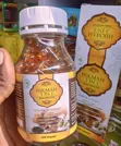 Kidney & Liver Detoxification Natural Therapy - 1